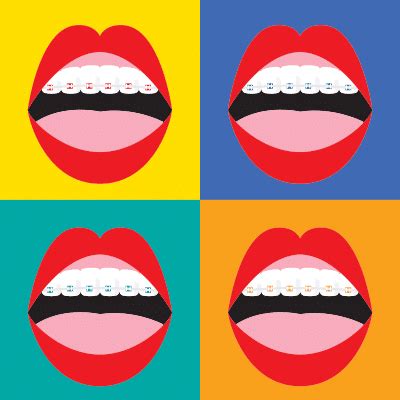 One topic that our patients always ask about is choosing colors for their braces. What Colors of Braces Should I Get | Omega Dental Houston TX