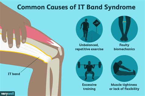 Syndrome De La Bande Iliotibiale It Causes Traitement Et Quand