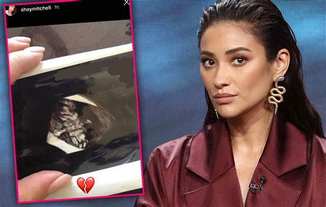 Pretty Little Liars Star Shay Mitchell Suffers A Miscarriage