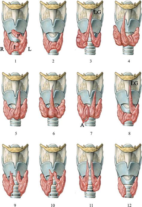 Anatomical And Surgical Aspects Of The Lobes Of The Thyroid Glands