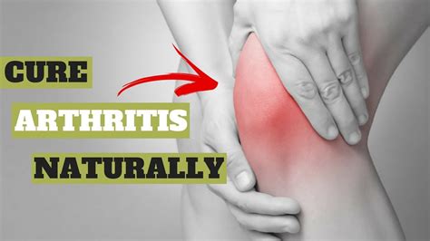 Cure Arthritis Naturally The Arthritis Step By Step Strategy Youtube