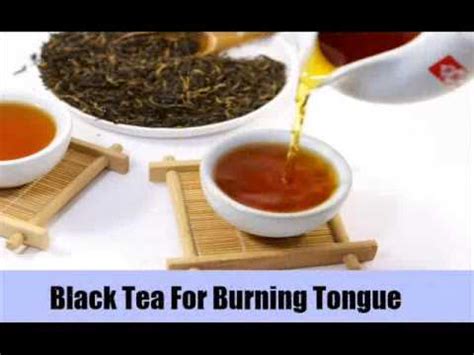 8 Natural Cures For Burning Tongue 