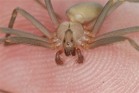 Best Pictures Artwork Hobo Spider Bite Treatment