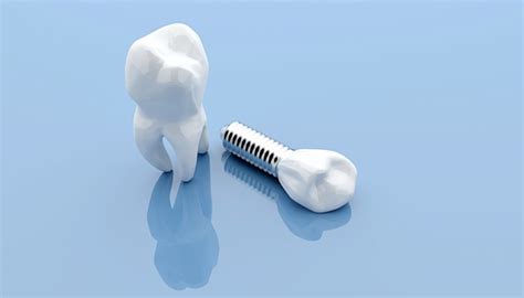 Dental implants are artificial tooth roots used to support a restoration for a missing tooth or teeth, helping to stop or prevent jaw bone loss. Can drug-loaded dental implants offer pain-free chronic ...