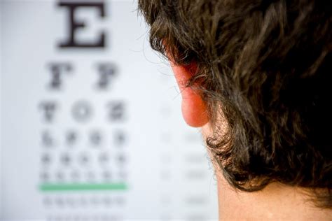 Myopia Symptoms Causes And Treatment Kraff Eye Institute