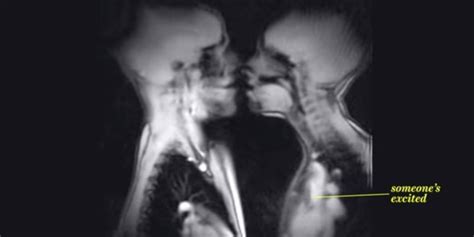 Human Sexual Intercourse X Ray Cumception