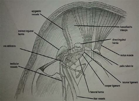 Inguinal Nerve Anatomy