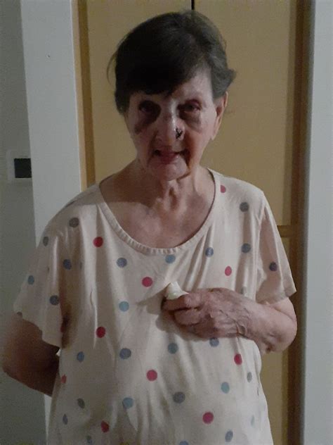 89 Year Old Woman Recovering After Being Punched In East Bakersfield
