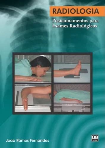 Radiologia Posicionamentos Para Exames Radiológicos Parcelamento Sem Juros