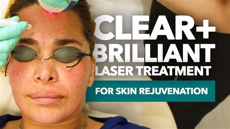 Clear And Brilliant Laser Treatment Clear Brilliant Los Angeles