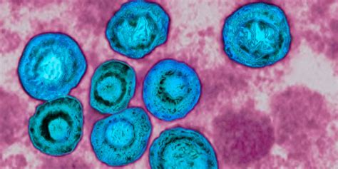 Bei einer viralen infektion gehen den herzbeschwerden unter umständen die. Zytomegalieinfektion | Vorsorge Heidelberg Frauenarzt Dr. Blumenstein