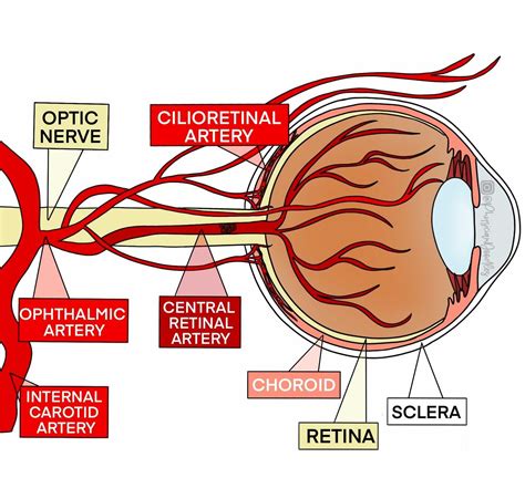 Retinal Vascular Occulsion Eent Content Blueprint Smarty Pance Panre
