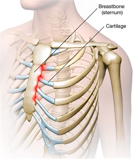 Picture Of What Is Under Your Rib Cage Sternum Pain