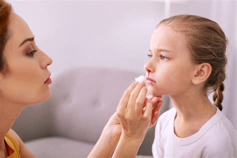 6 cosas que debe saber sobre las hemorragias nasales en niños y adultos