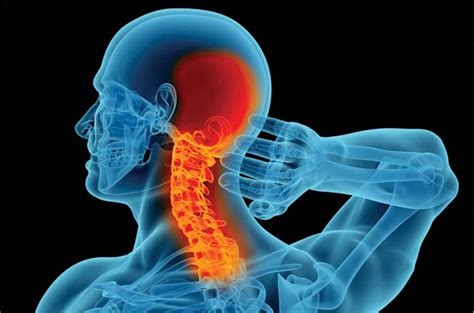 Cervical Spine Neck Pain What You Should Know About The Cause And