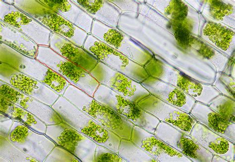 Elodea Cell In Salt Water Water Ionizer