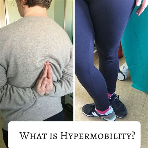 Hypermobility And Your Health Sara Russell Phd Ntp