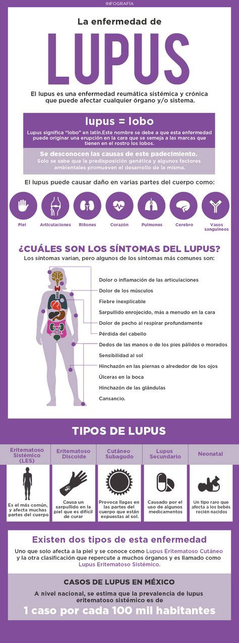 ¿qué Es El Lupus Salud Infografia Salud Salud Y Ejercicio