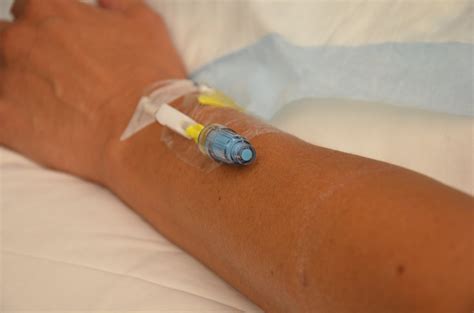 A Nurse Has Just Inserted A Peripheral Iv Catheter For A Continuous