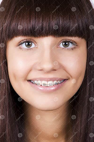 Happy Teen With Braces Stock Photo Image Of Girl Open 21548016