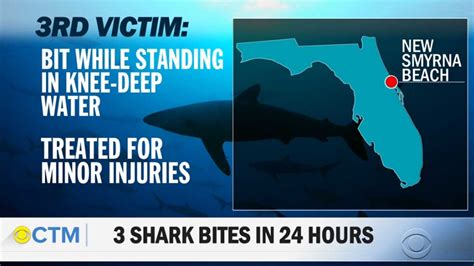 3 Shark Attacks At The Same Florida Beach Within 24 Hours