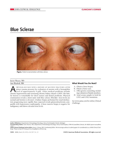 Blue Sclerae Congenital Defects Jama The Jama Network