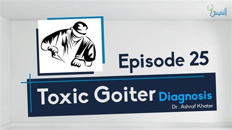 Toxic Goiter Diagnosis 04 Surgery Prof Ashraf Khater Youtube