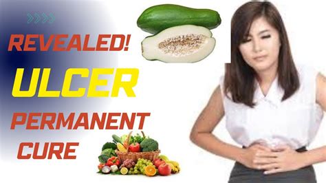 Unbelievable Permanent Cure For Ulcer Youtube