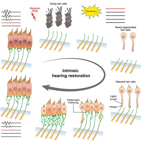 Hair Cell Regeneration Reinnervation And Restoration Of Hearing