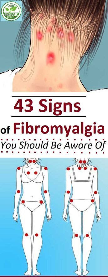 43 Signs Of Fibromyalgia You Should Be Aware Of Signs Of Fibromyalgia Fibromyalgia