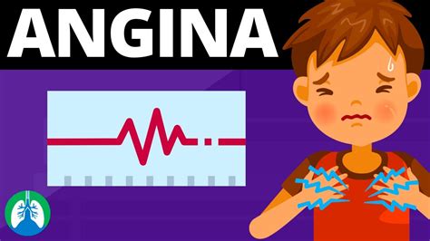 Angina Medical Definition Quick Explainer Video Youtube