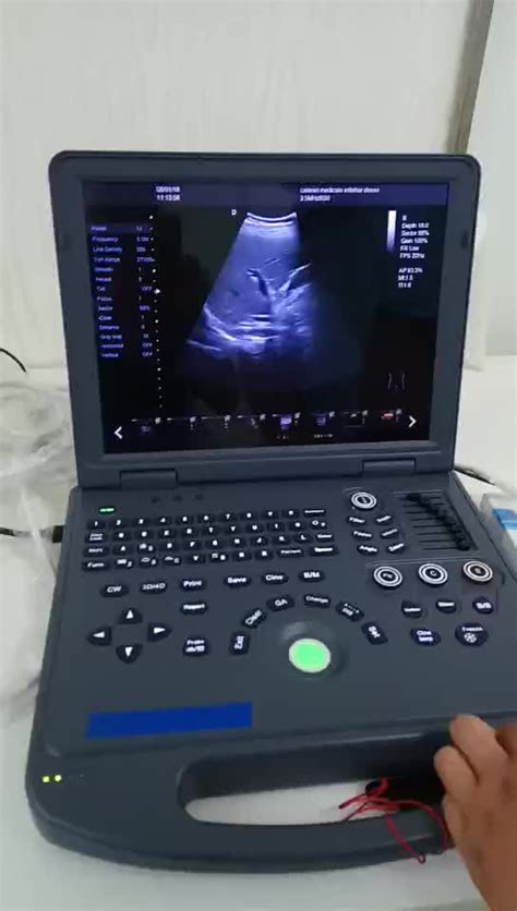 Clear Imaging 3d4d Portable Color Doppler Echocardiography Ultrasound