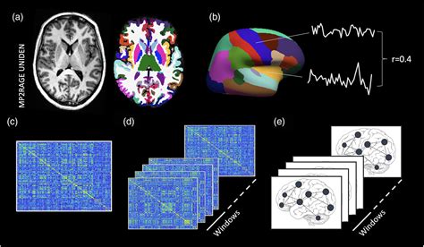 Human Brain Mapping Neuroimaging Journal Wiley Online Library