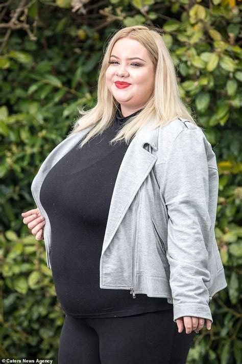 Meet 25 Year Old Lady With Gigantic Breasts That Wont Stop Growing Due To A Rare Condition