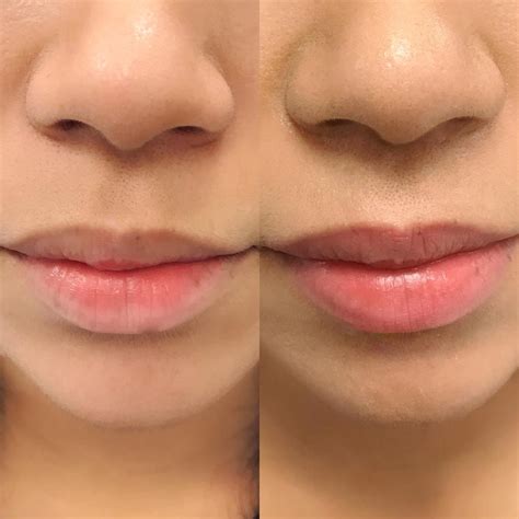 Lip Blush New Trend In Permanent Makeup Lip Tattooing Permanent