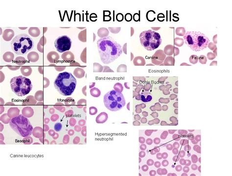 Types White Blood Cells Infographics Royalty Free Vec