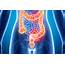 What Are Bowel Cancers Signs The Symptoms Of Condition 
