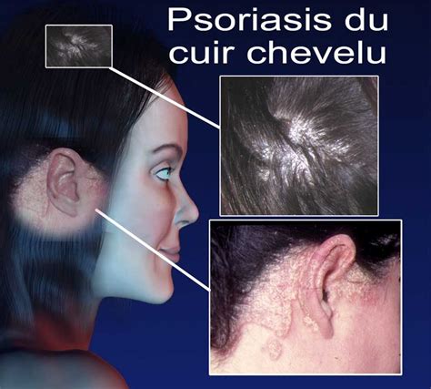 Il y a quelques temps cela a même été violent. les Différentes Causes de Douleur du cuir Chevelu ...