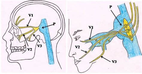 Attachment Of Trigeminal Nerve To Pons And Its Three Branches