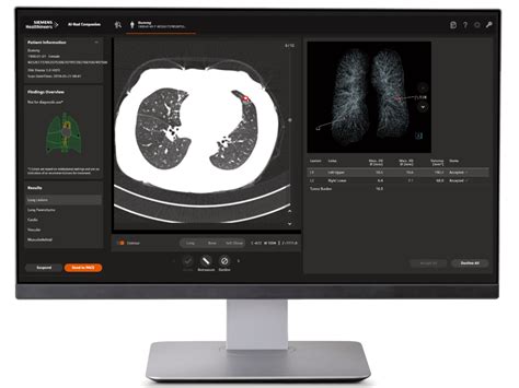 Digital Radiography System Ysio Max