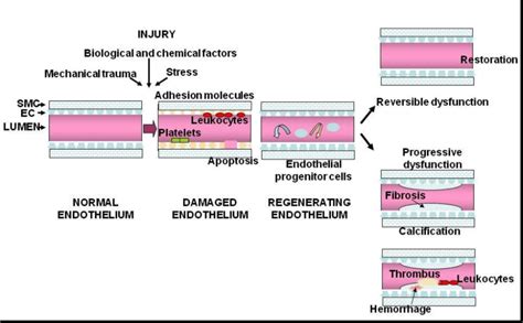 Endothelial Injury And Repair Outcome Physiological And Life Style