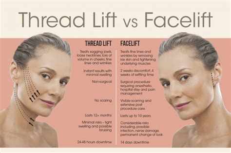 Facelift Or Thread Lift