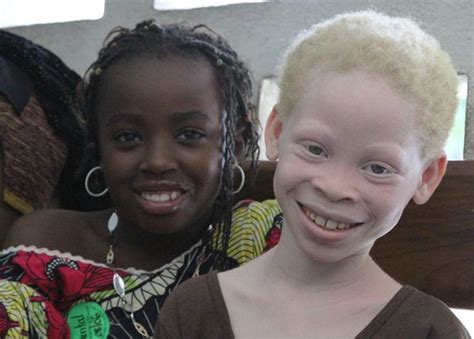 Deepest Hued Phenotypes Page 12 Beautiful People Albino African