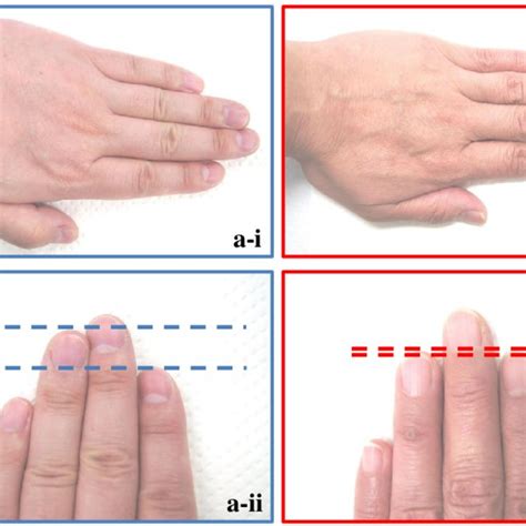 relationship between the difference in ring and index finger lengths download scientific