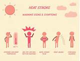 Photos of Heat Syncope Symptoms