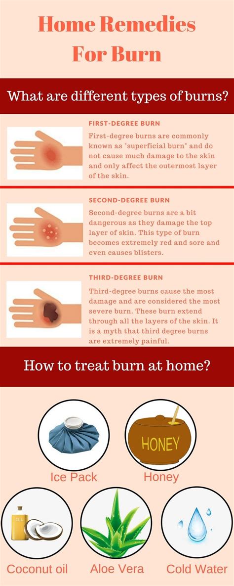 Home Remedies For Burn What You Should Do Firstdegreeburn Home