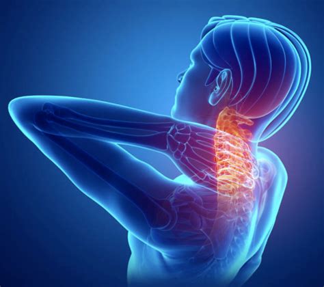 Quick Relief For Chronic Neck Pain Vanguard Interventional Pain