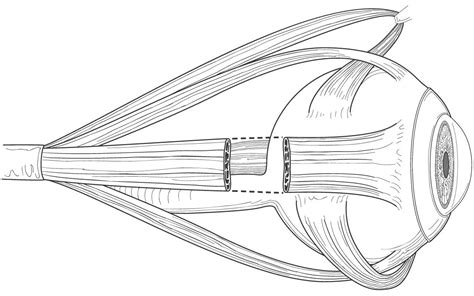 Eye Muscles Profile Line Art American Academy Of Ophthalmology