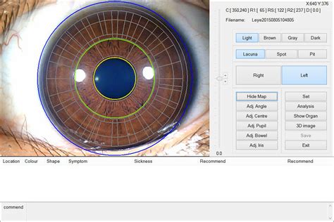 12 0MP Digital Iriscope Iridology Camera Eye Testing Machine CE DHL