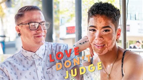 how will my blind date react to my vitiligo love don t judge